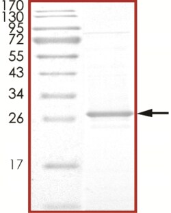 Sino Biological&nbsp;Recombinant Human NRAS Protein (Q61K, AVI & His Tag), Biotinylated